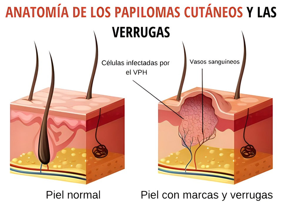 WIPEOFF - Removedor de imperfecciones